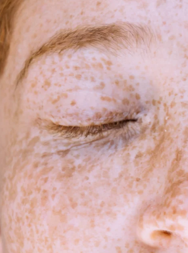 OPSIA Lumina - Anti-Dark Spot Cream with Kojic Acid 50ml / 1.69 fl oz