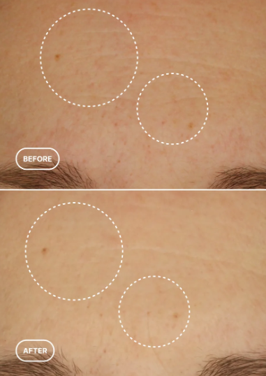 OPSIA Eye Serum - Retinol Alternative 30 ml / 1.01 fl oz